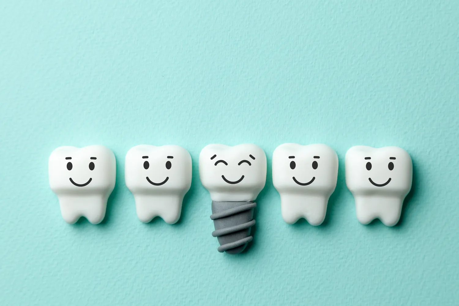 Jak długo goją się implanty?