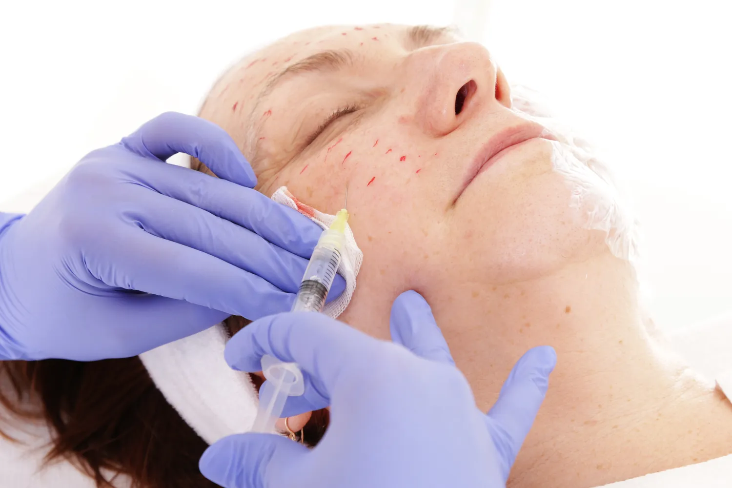 Medycyna estetyczna szczecin gdzie najlepiej?