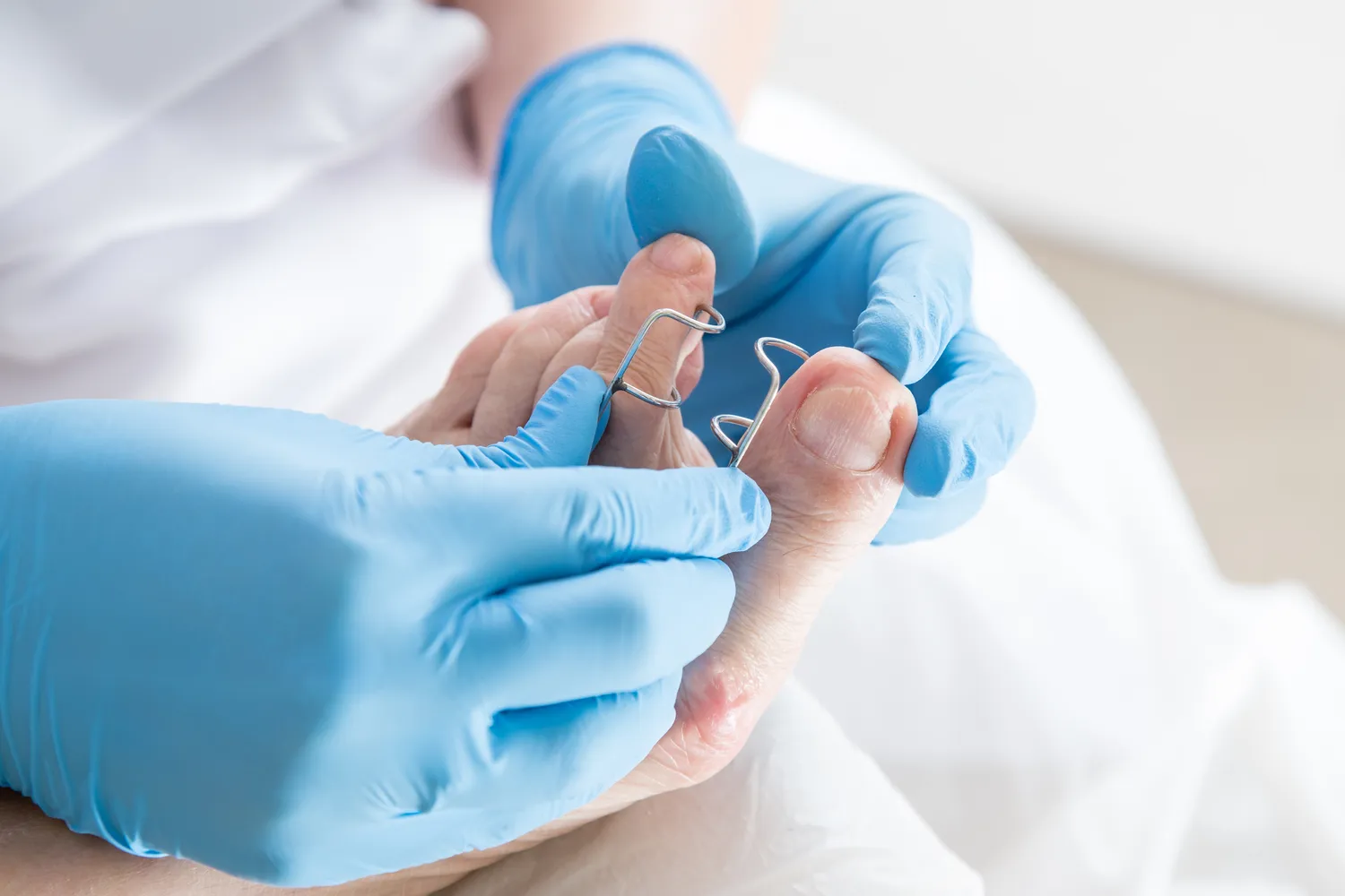 Czym zajmuje się podologia?