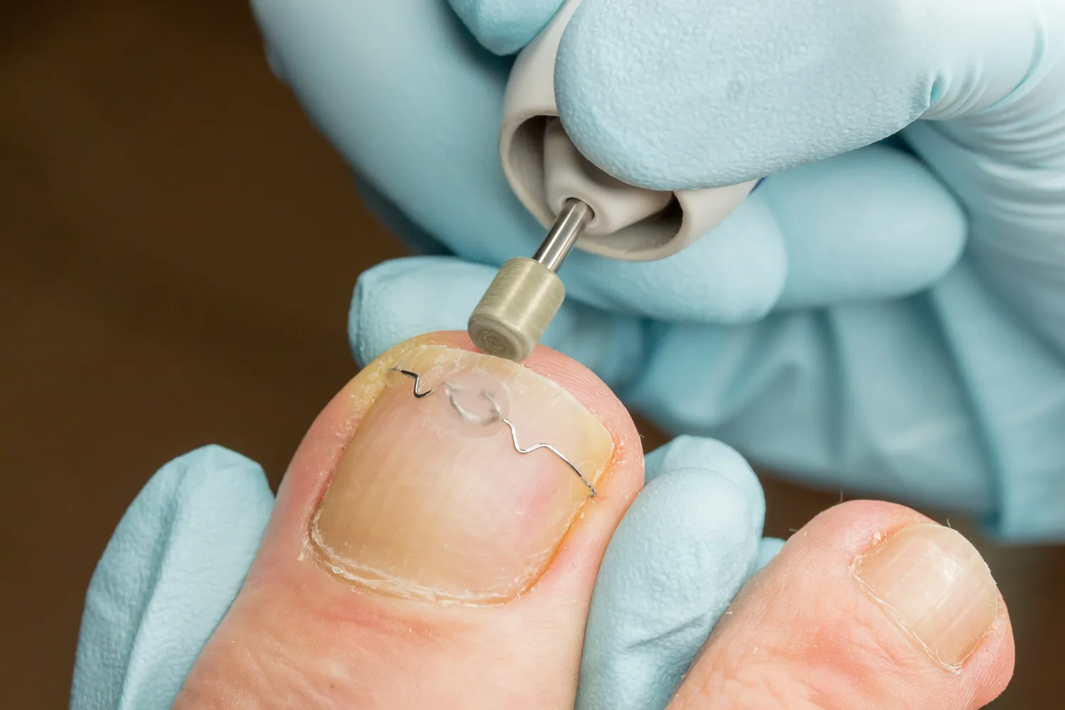 Kim jest podolog i kiedy należy go odwiedzić? 