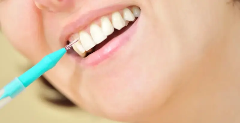 Licówki porcelanowe ranking Szczecin