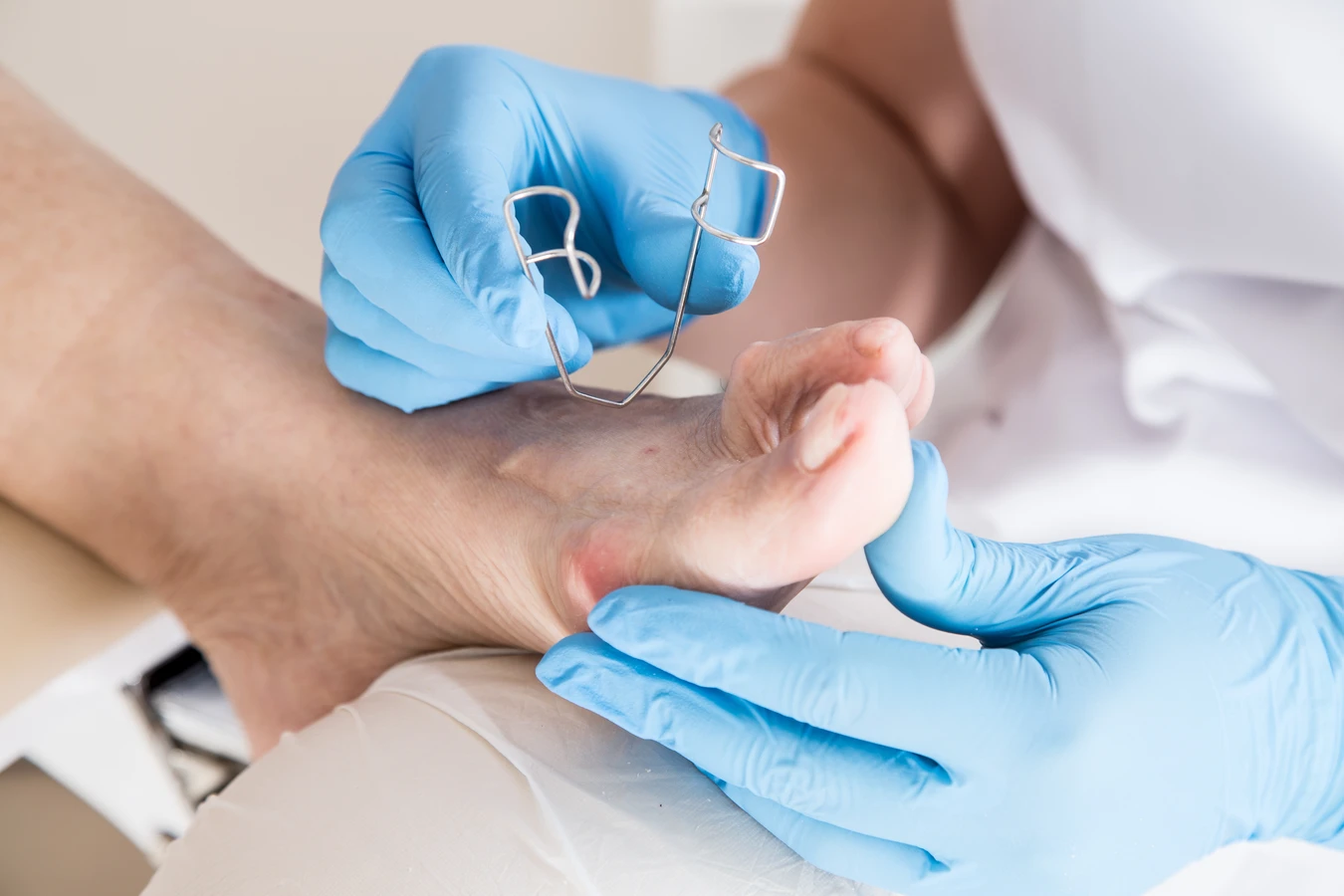  Podologia - co to takiego?