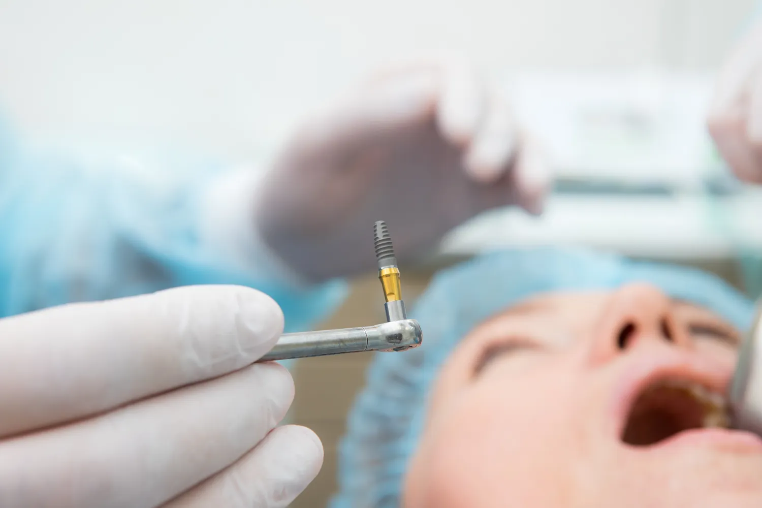 Endodoncja mikroskopowa szczecin